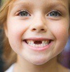Для чего лечить молочные (временные) зубы, они же и так, выпадут?!